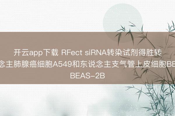 开云app下载 RFect siRNA转染试剂得胜转染东说念主肺腺癌细胞A549和东说念主支气管上皮细胞BEAS-2B